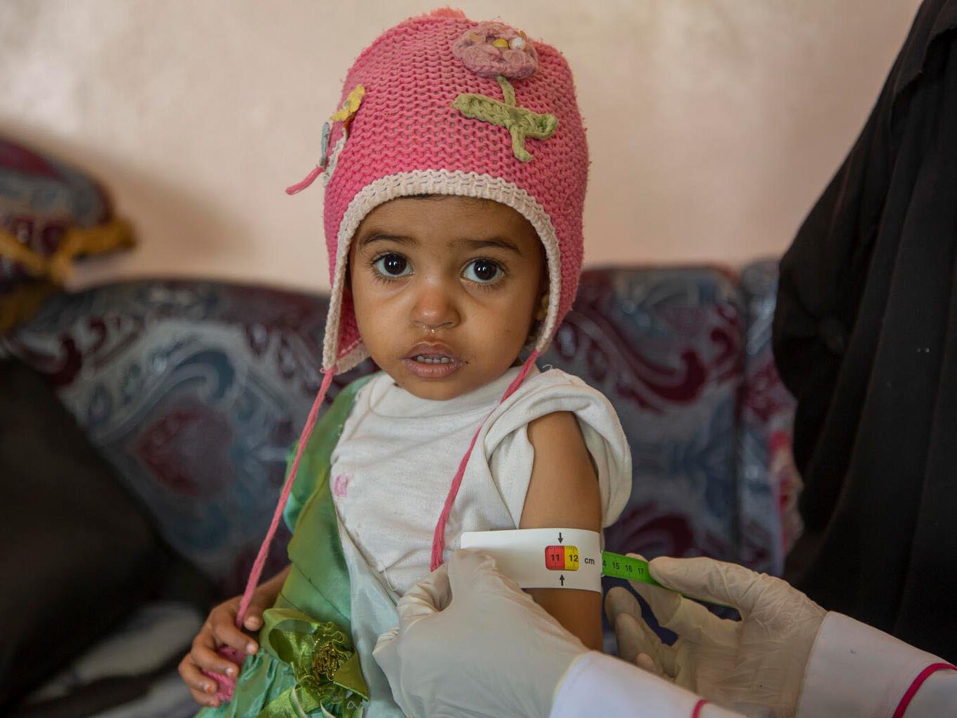 Ein Kind wird mit einem Armband auf Mangelernährung untersucht.
