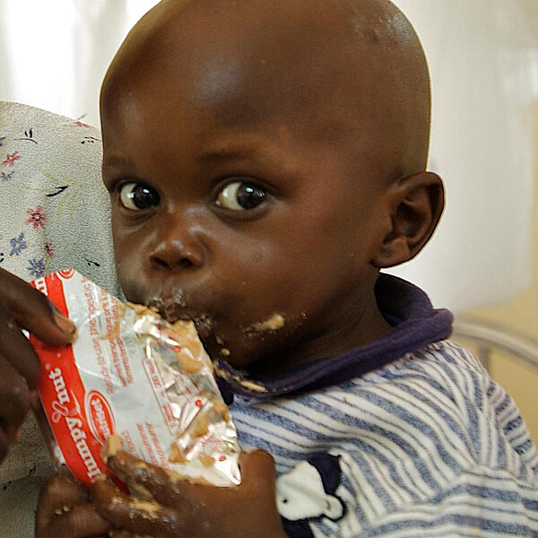 Kind isst Erdnusspaste gegen Mangelernährung