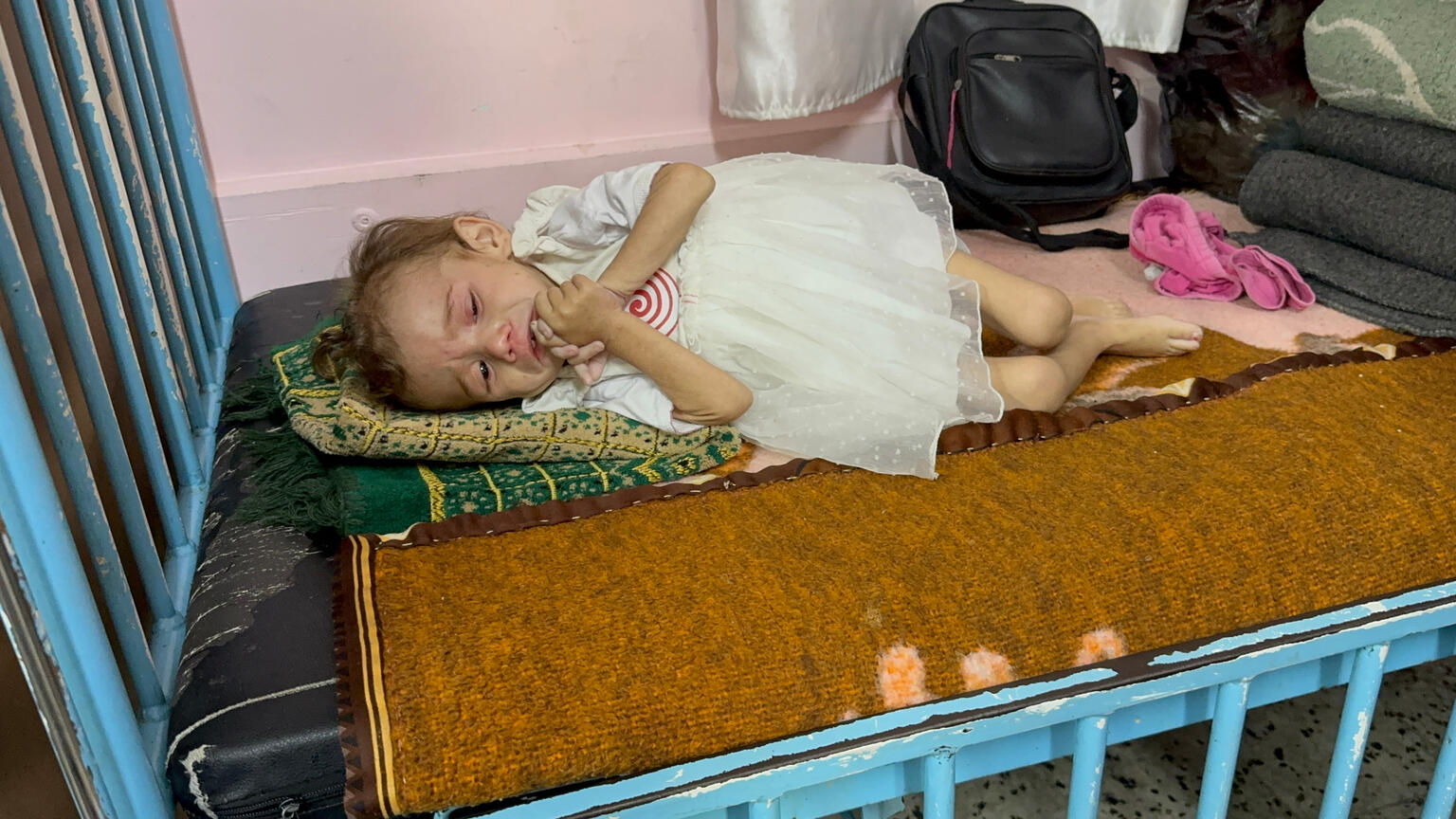 Ein mangelernährtes Kind im Gazastreifen.
