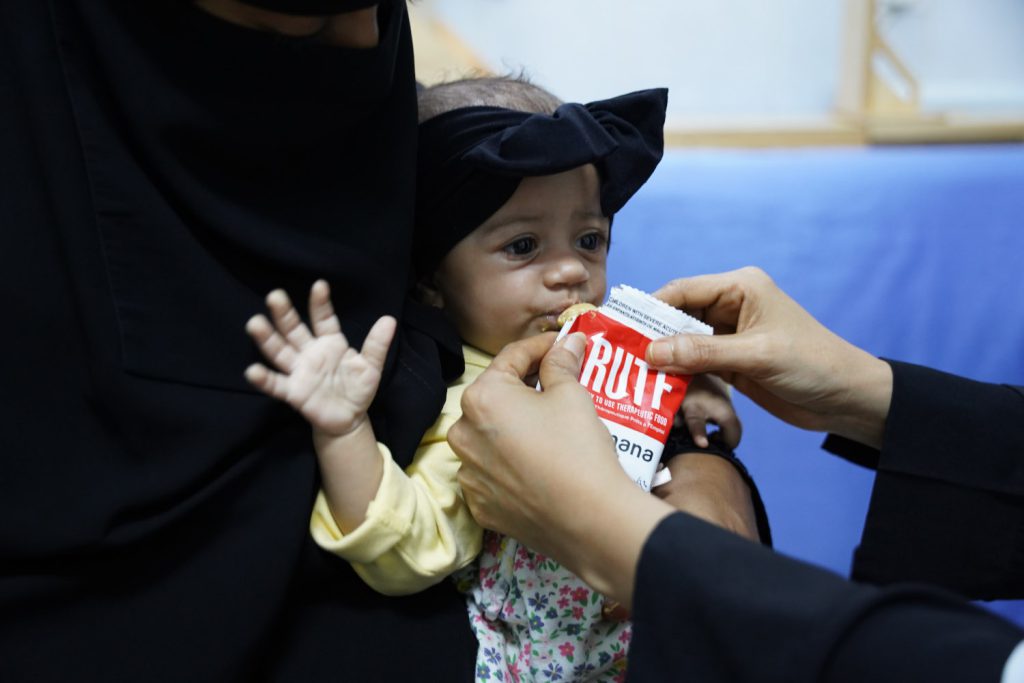 Mangelernährtes Kleinkind im Jemen isst Erdnusspaste.