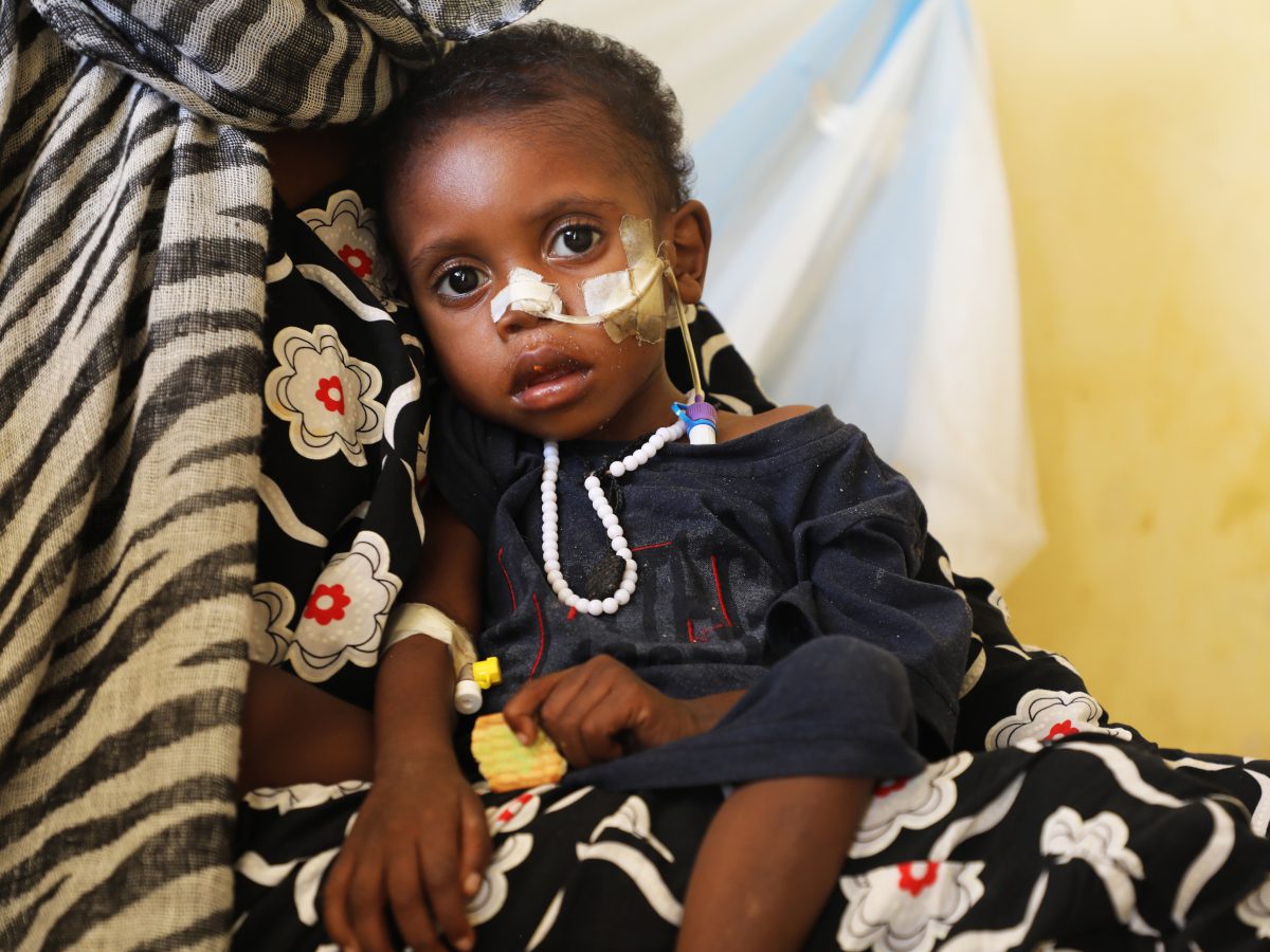 Schwer mangelernährtes Kind im Tschad wird in Gesundheitszentrum behandelt.