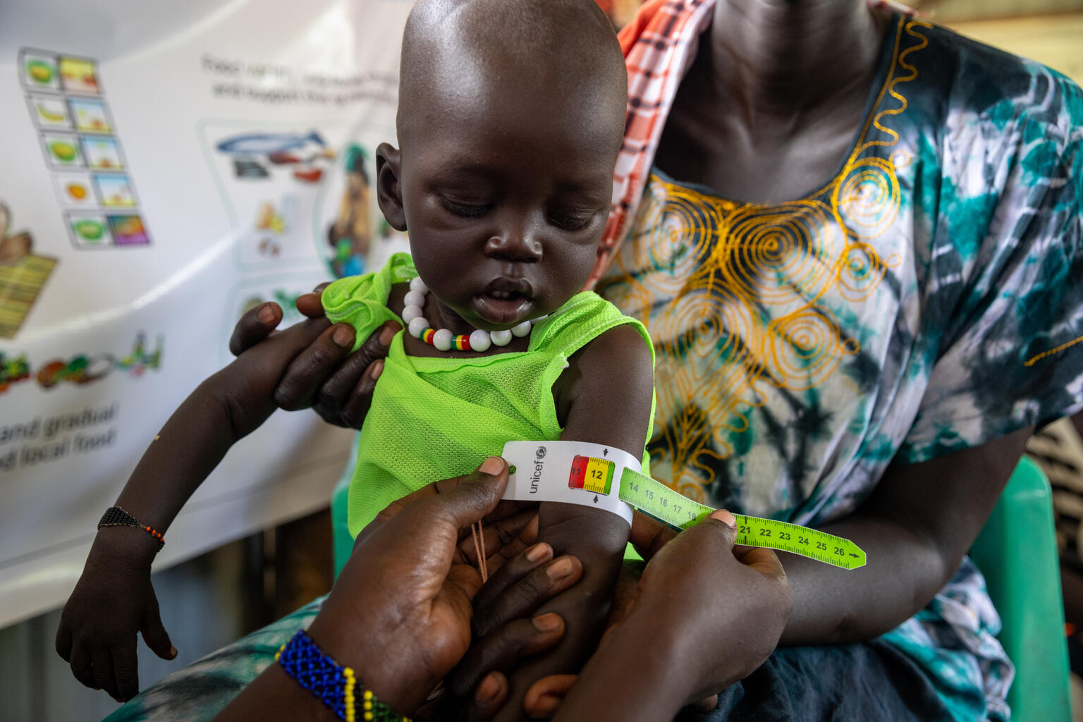 Kinder im Südsudan werden auf Mangelernährung untersucht.