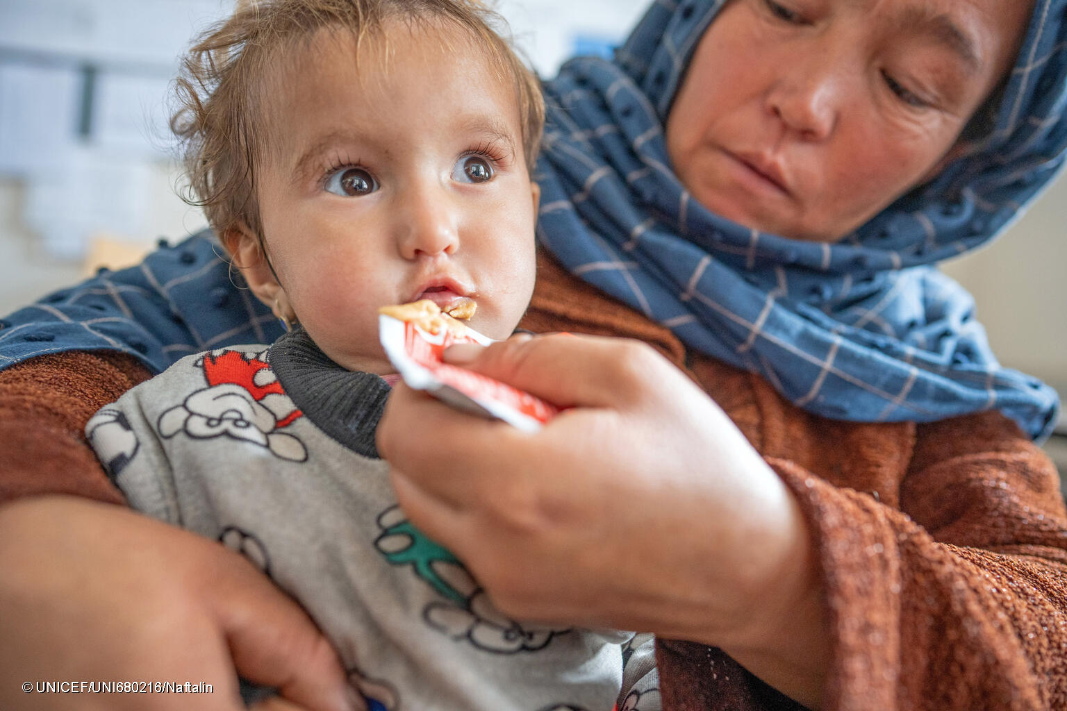 Ein Kind in Afghanistan bekommt Spezialnahrung.